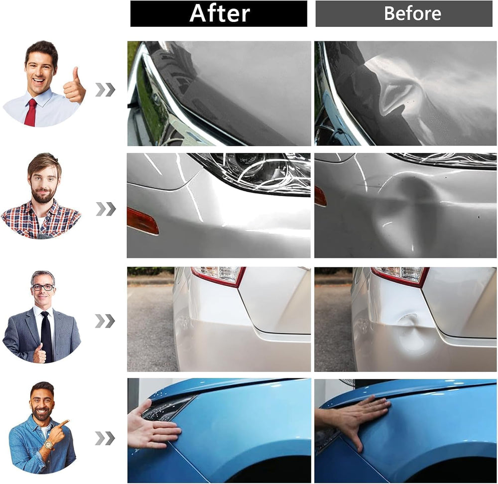Auto Paintless Dent Removal Kit – Adjustable Paintless Dent Repair Tool for A...