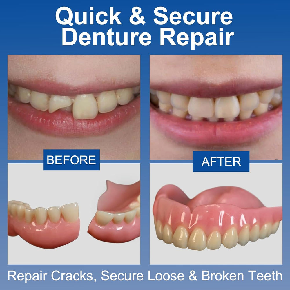Dental Lab Instant Bonding Dental Glue (1 oz), Repair Cracks, Secure Loose &a...